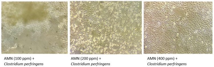 Visión microscópica de enterocitos y Clostridium perfringens
